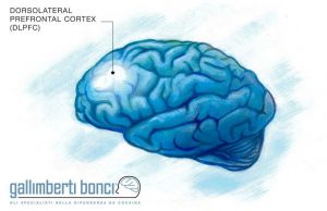 Stimolazione magnetica transcranica (TMS) - Gallimberti Bonci